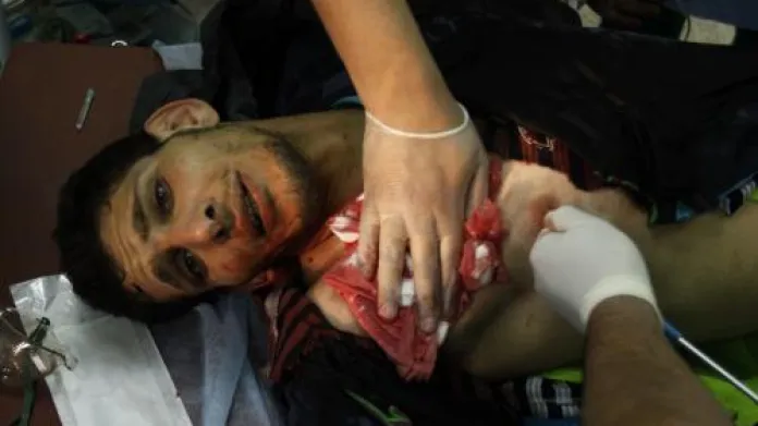 Zraněný libyjský bojovník
