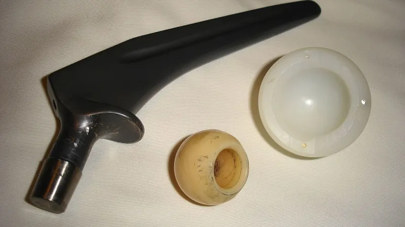 Titanová protéza s keramickou hlavou a polethylenovou jamkou