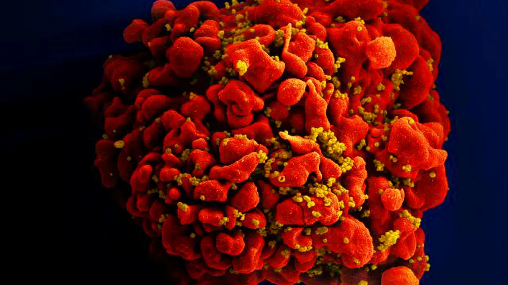 Virus HIV