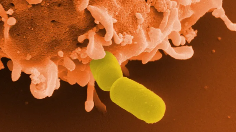 Listeria monocytogenes