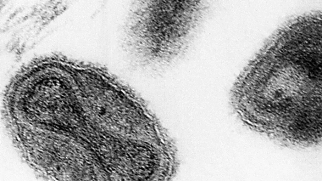 Virus pravých neštovic
