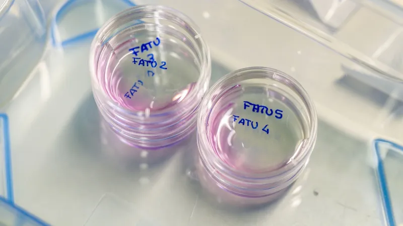 Vajíčka odebraná nosorožcům