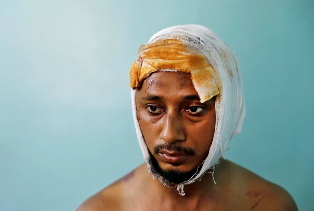 Zraněný muž byl napaden během protestů v indickém Dillí. Proti sobě se tam postavili muslimové a hinduisti, kteří se neumí shodnout na novém zákoně. Ten upravuje možnosti získání indického občanství