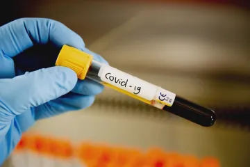 Vláda vyřadila covid-19 ze seznamu nemocí, jejichž šíření je trestným činem. Povinné izolace skončí v půlce dubna