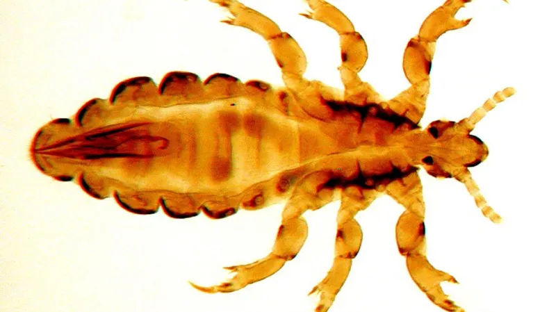 Samec současné vši dětské