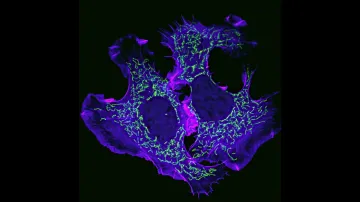 Třetí místo: Protein aktin a mitochondrie v buňkách nádoru mozku myši. Autor: Eric Vitriol, USA
