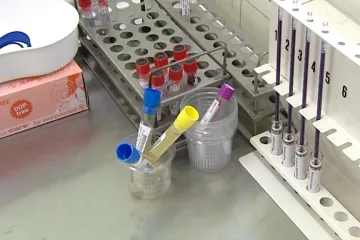 Na Pardubicku vrcholí epidemie příušnic