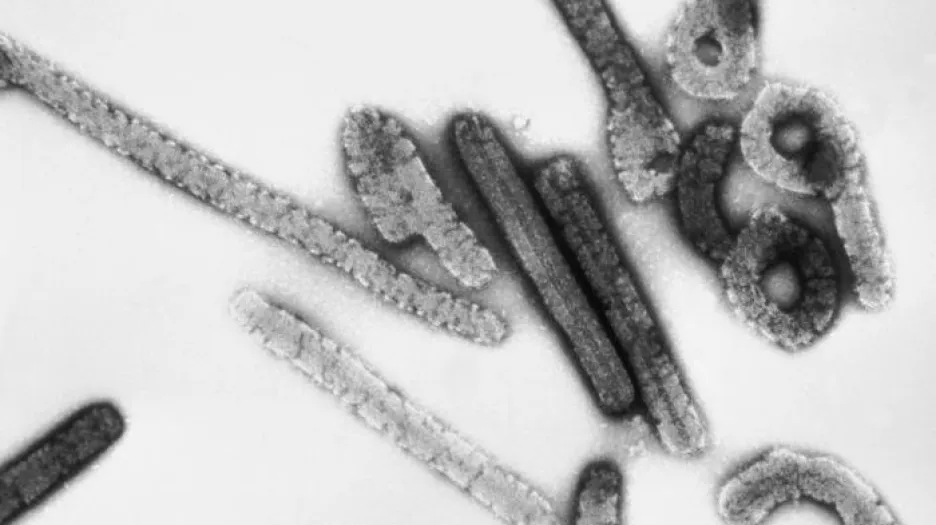 Virus marburg