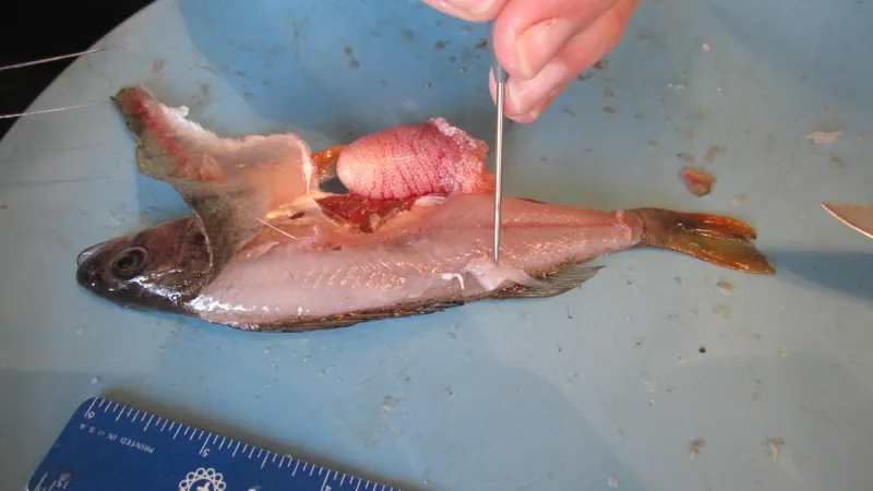 Larva škulovce širokého ve svalovině okouna říčního