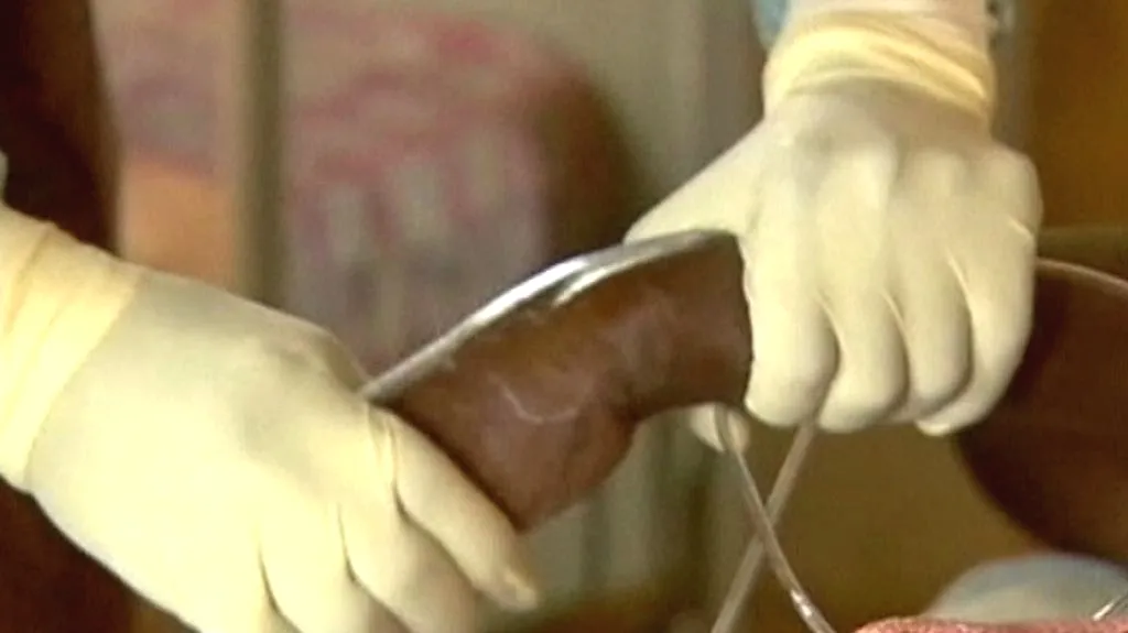 V Ugandě znovu propukla ebola