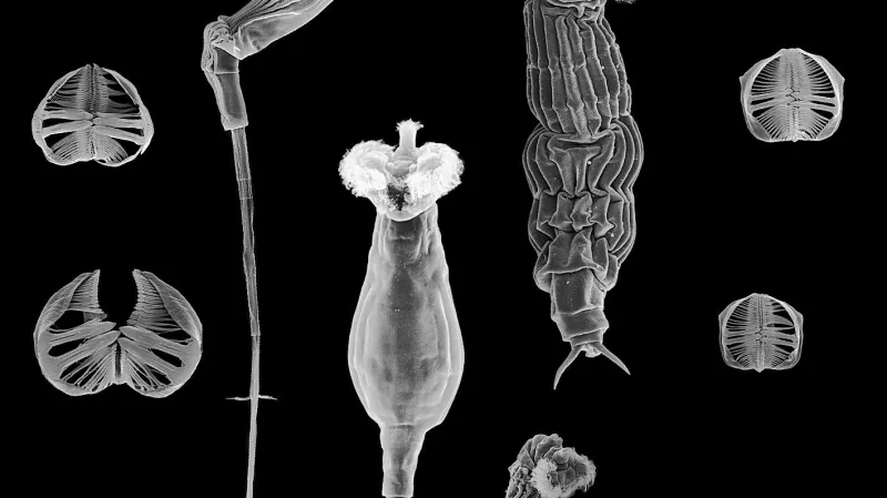 Pijavenka pod mikroskopem