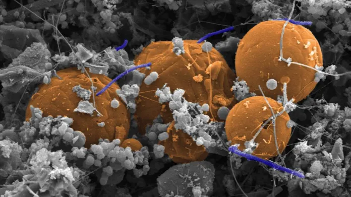 Bakterie Candidatus Desulforudis audaxviator (fialová)  přichycená na koulích z uhlíku