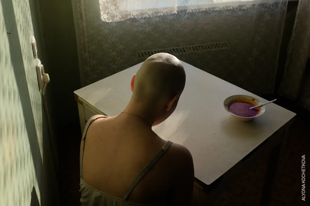Nominace na vítěznou fotografii v kategorii LIDÉ (single): Alonya Kochetkova – Když jsem byla nemocná