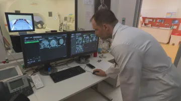 AI pomáhá vyhodnocovat snímek z magnetické rezonance