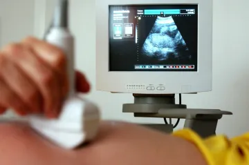 Žena zemřela na komplikace po císařském řezu, Ústavní soud dává naději na odškodnění