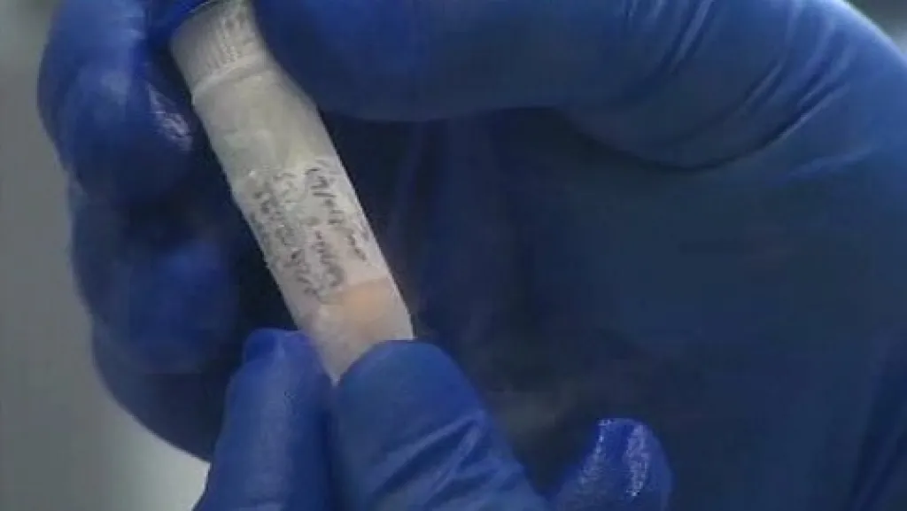 Zmrazený vzorek spermatu