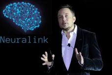 Neuralink funguje, oznámil Musk. První pacient dokáže myšlenkami ovládat kurzor