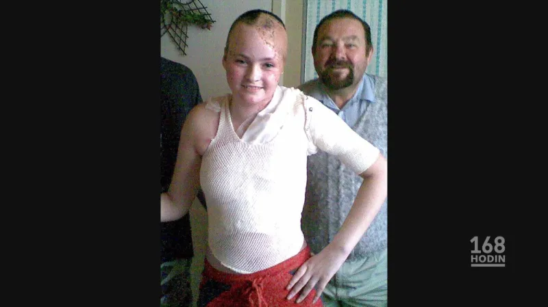 Následky úrazu proudem si Simona a Daniel ponesou celý život