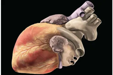 Umělá inteligence dokáže předpovědět infarkt až deset let dopředu