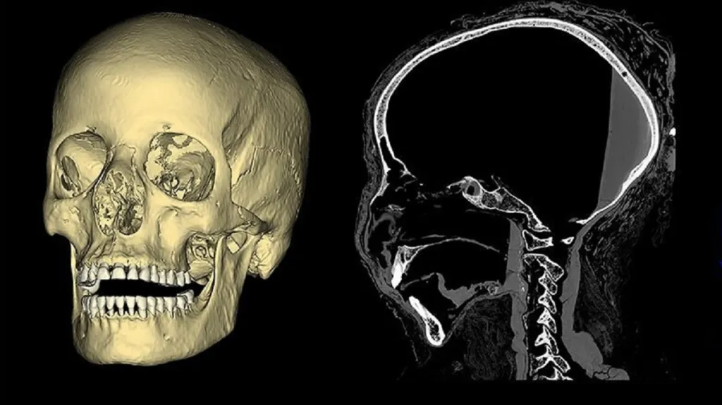 Počítačový sken lebky mumie