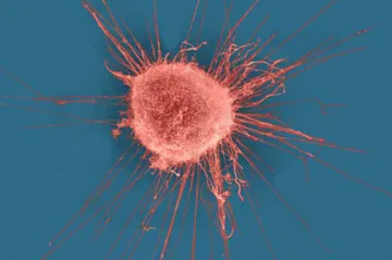 Rakovina se v těle šíří záludněji a rychleji než se dosud soudilo