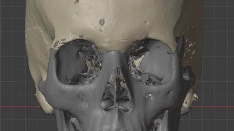 Průběh rekonstrukce