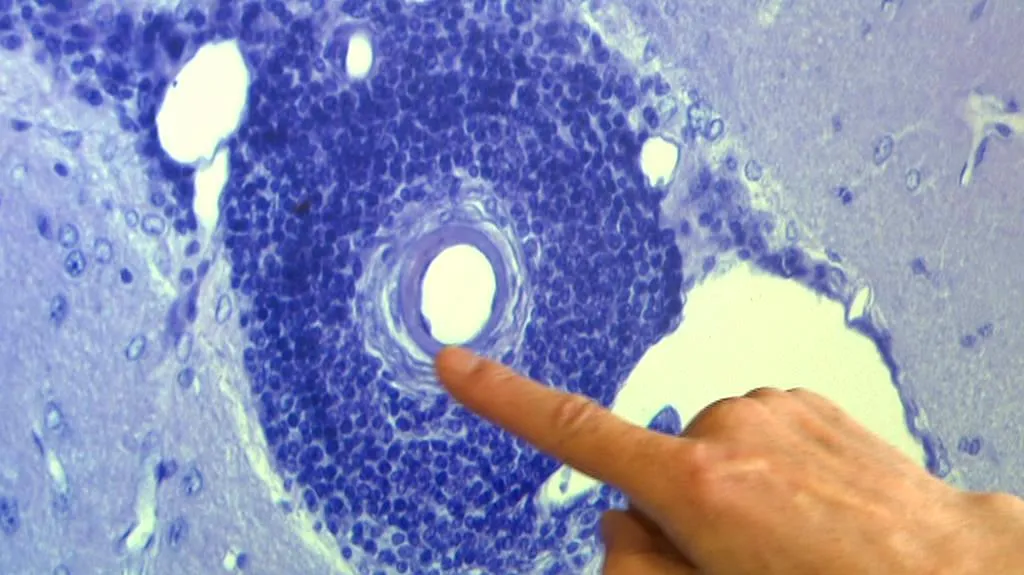 Výzkum toxoplazmózy