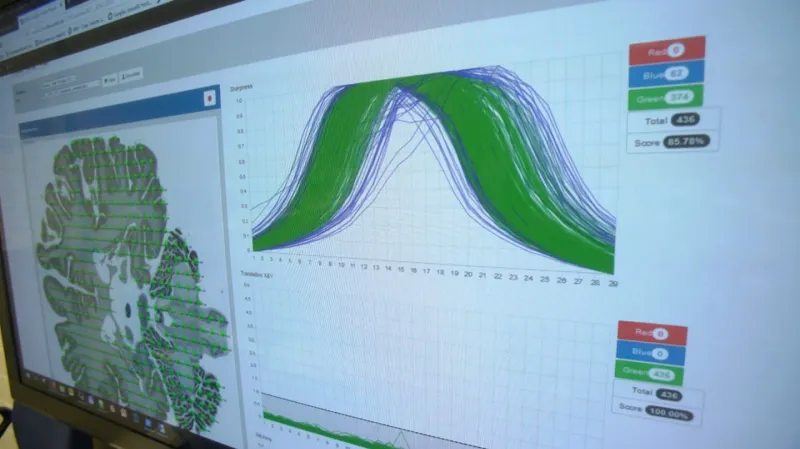 Simulace mozkové aktivity