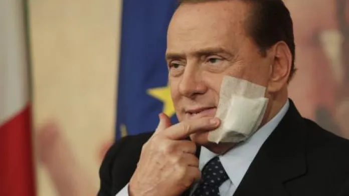 Italský premiér Silvio Berlusconi po operaci čelisti