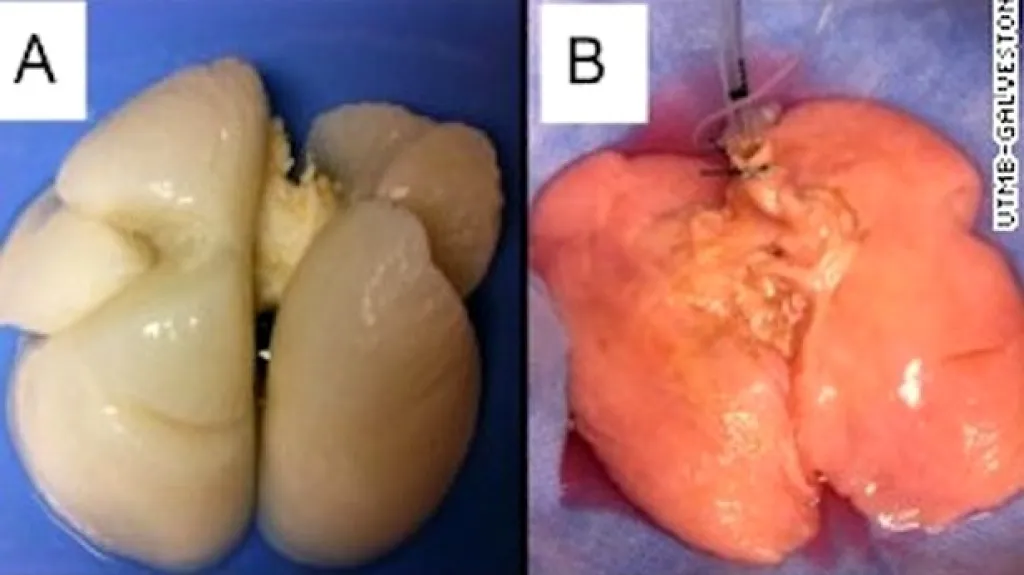 První lidské plíce z laboratoře