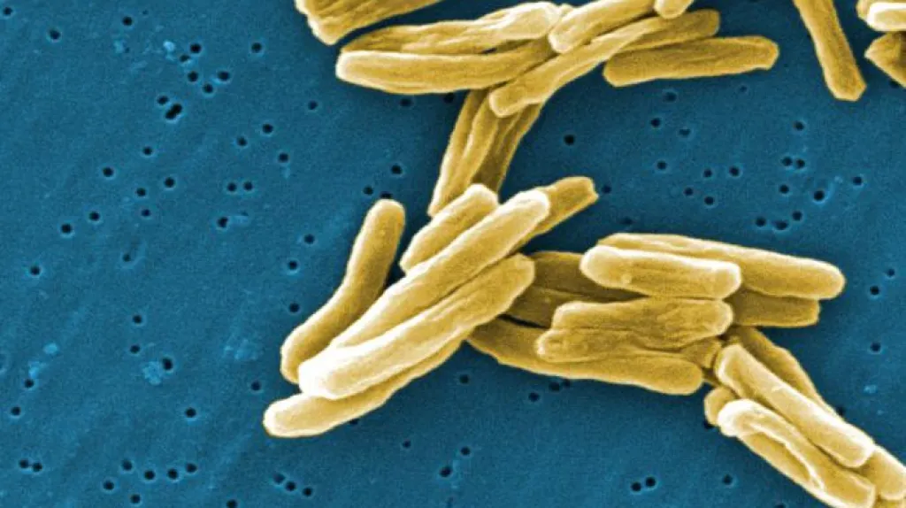 Mykobakterium způsobující tuberkulózu