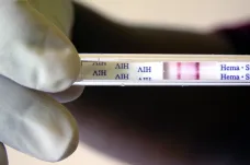 Začíná Evropský týden testování na HIV a žloutenku, vyšetření je zdarma