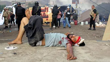 Raněný egyptský demonstrant