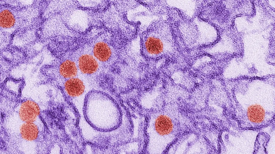 Virus zika
