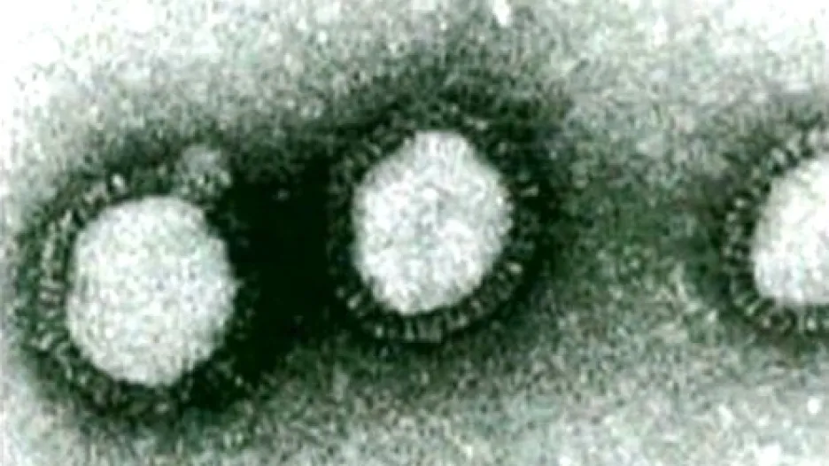Virus prasečí chřipky