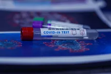 Nový přesný test na koronavirus znamená přelom. Stojí 10 dolarů, je ze slin a jeho autoři se vzdali zisku