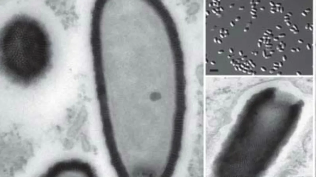 Améba napadená 30 000 let starým virem