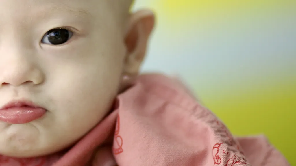 Dítě s Downovým syndromem