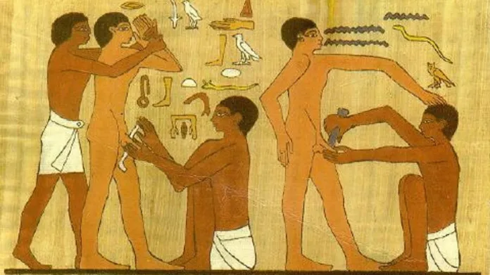 Egypťané ovládali řadu zákroků, které jsou rizikové i dnes – včetně obřízky