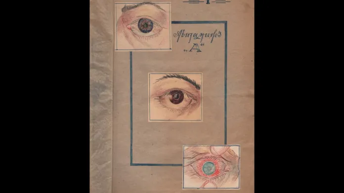 Ilustrace k práci vězenkyně a lékařky Jekatěriny Goľc o avitaminóze v gulagu z archivu Muzea Mezinárodního Memorialu
