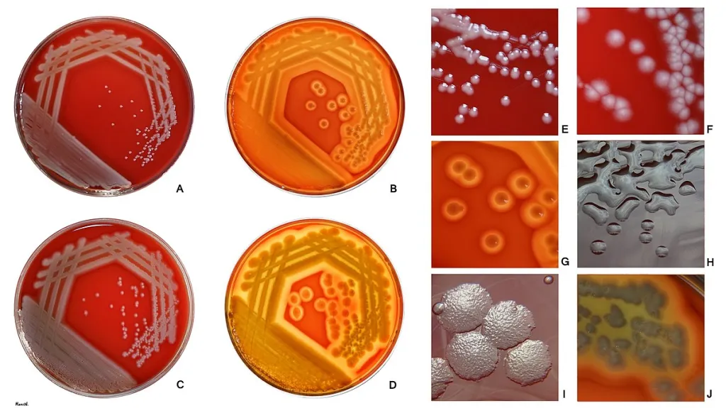 Pseudomonas aeruginosa