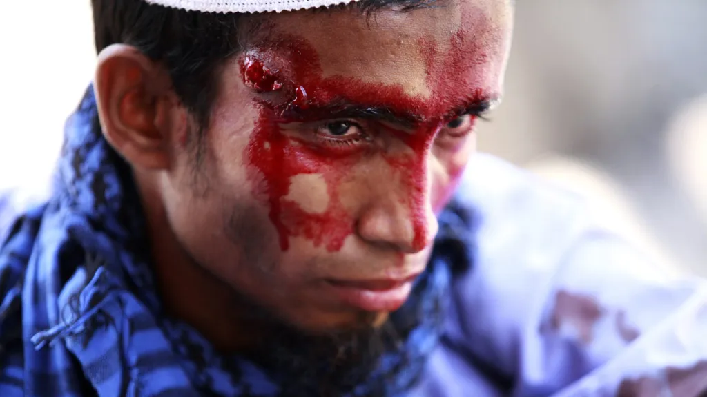 Zraněný po demonstraci v Dháce