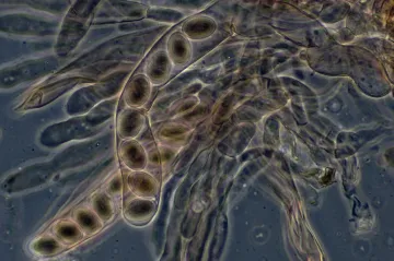 Čeští vědci přišli na to, jak se rostliny přátelí s houbami. Našli gen, který je za to zodpovědný