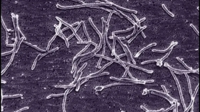 Bakterie Thermus aquaticus