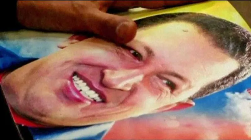 Chávezův stav je prý kritický