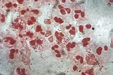 Kapavka odolná proti antibiotikům se přiblížila k českým hranicím. První případ hlásí Rakousko
