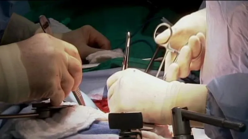 Transplantační problematika tématem Událostí