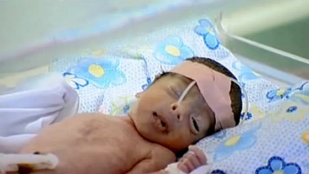 V Iráku se rodí zmrzačené děti