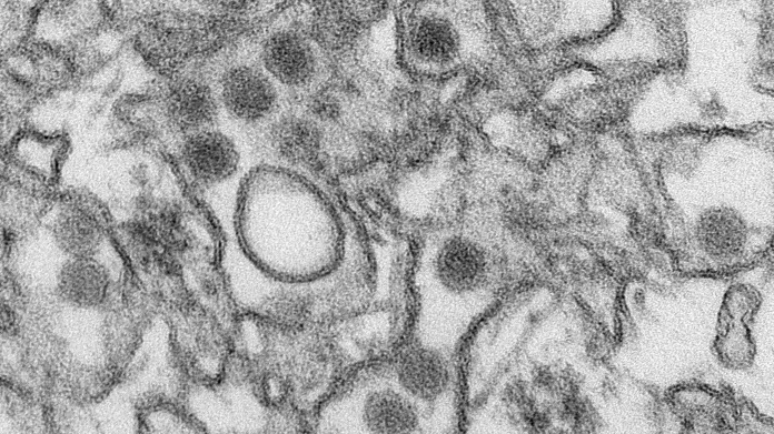 Detailní snímek viru zika