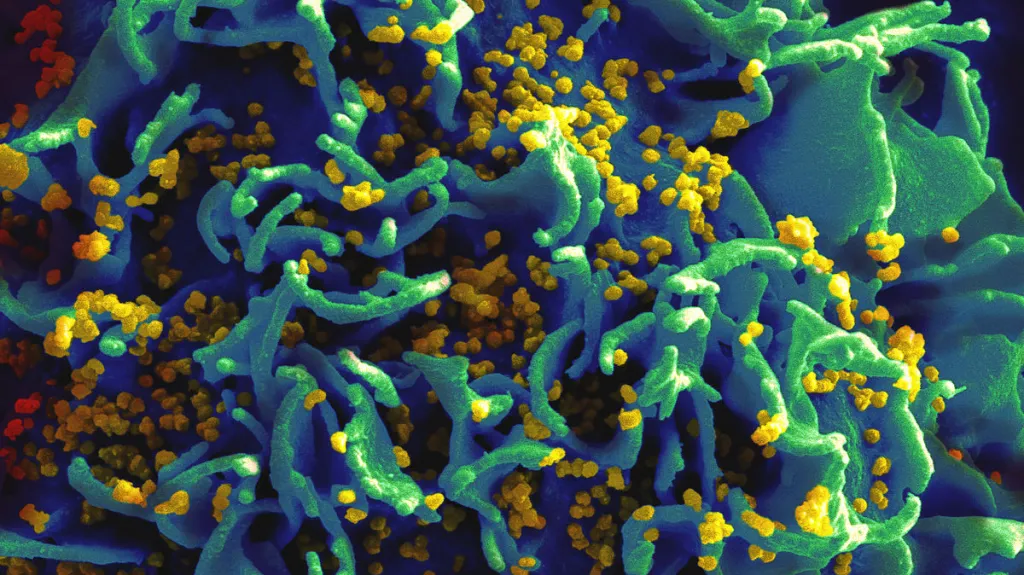 Virus HIV